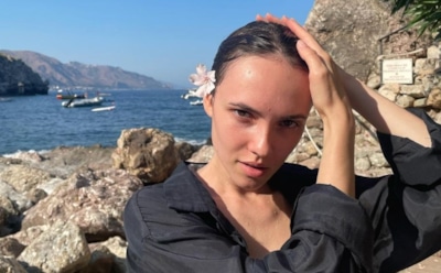 Актрисе Стасе Милославской прооперировали ногу