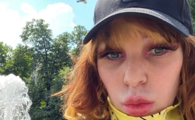 Жанна Агузарова вернула прежнюю внешность при помощи пластики