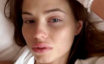 Невестка Валерии вышла на связь после операции