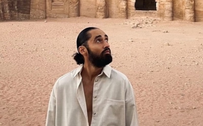 Певец Мот получил травму на концерте