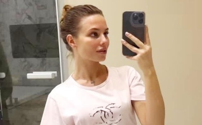 Невестка Валерии пострадала после похода в солярий