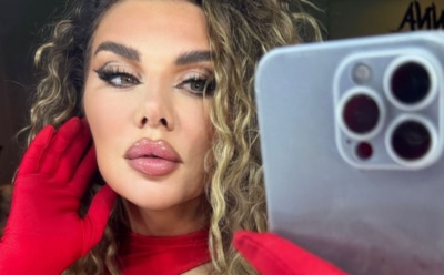 Падение Анны Седоковой привело к двойному перелому ноги