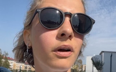 Полина Максимова показала заплывшее лицо после нападения пчелы