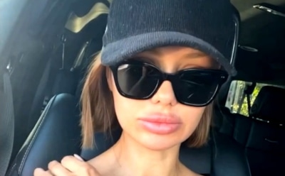 Викторию Боню перестали узнавать на улице после пластики