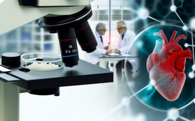 Ученые сообщили об угрозе проникновения микропластика в артерии