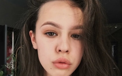 У Инстасамки начались проблемы со здоровьем после пластики