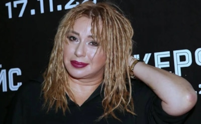 Алена Апина показала результат подтяжки подбородка