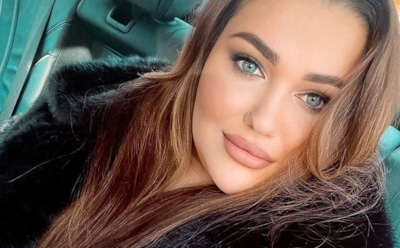 Дочь Пригожина показала фигуру после пластики