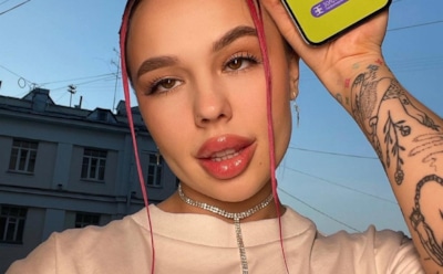 В Думе хотят установить стандарт увеличения губ для россиянок