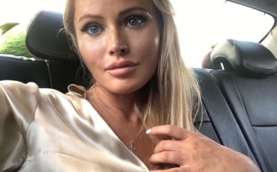 «Напоминала Брежнева»: Дана Борисова показала лицо через месяц после пластики