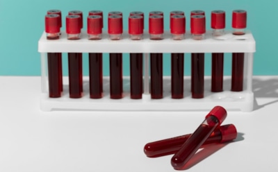 Группа крови и риск онкологии: новые мифы от зарубежных исследователей — комментарии российского гематолога