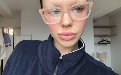 Инстасамка чудом спаслась из пожара: певица раскрыла подробности ЧП в Москве