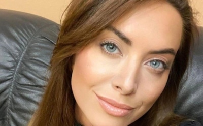 Наложили пять швов: подруга разбила лицо Наталье Фриске