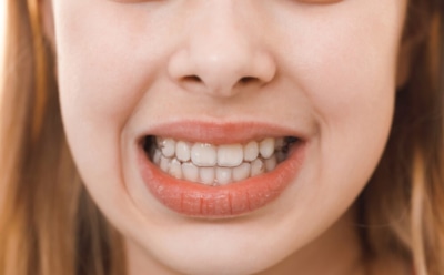 Зубовный скрежет с риском для здоровья: частые причины и основные признаки бруксизма — как справиться с проблемой