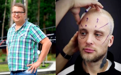 Егор Холявин снова лег под нож: звезде «Дома-2» сделали 31 операцию