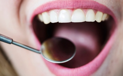 Алкогольный удар по зубам: влияние кислот и сахара на эмаль — советы ортодонта для защиты в праздники