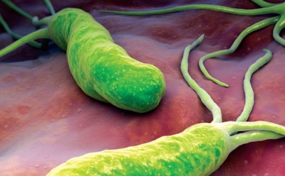 Опасные факторы рака: воспаление слизистой — советы врача по профилактике