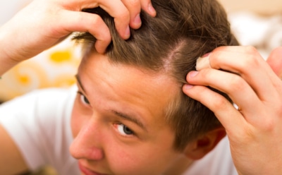 Подростковая алопеция: энергетики и спортпит провоцируют облысение — причины и способы борьбы