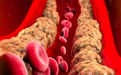 Холестерин важен для здоровья: врач объяснила, как поддерживать баланс — простые советы