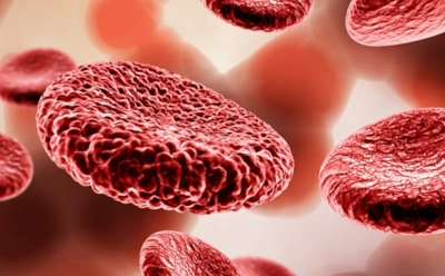 Не только дефицит железа: как найти истинную причину анемии — рассказал доктор Мясников