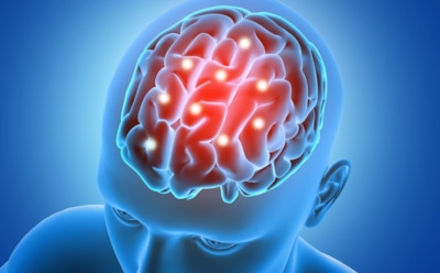 От инсульта до Альцгеймера: как своевременно распознать угрозу для мозга — запомните эти сигналы раз и навсегда