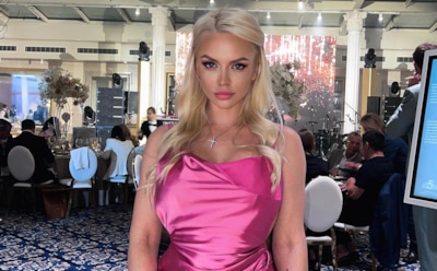 Франкенштейн позавидует: Милана Тюльпанова зареклась обращаться к хирургам после 10 операций