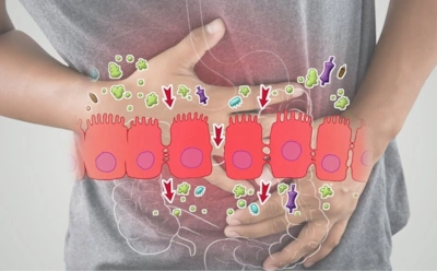 Неудобная правда о «дырявом кишечнике»: что на самом деле стоит за модным диагнозом из Сети — гастроэнтерологи бьют тревогу