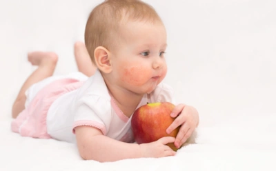 Есть шанс избавиться навсегда: врач рассказал, какие пищевые аллергии проходят у детей — но есть нюанс