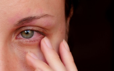 Ваши глаза будут благодарны: врач рассказал, как избежать сухости и покраснения летом