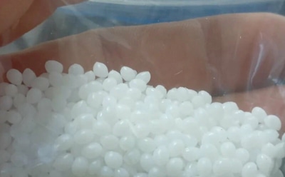 Стоматологи бьют тревогу: стало известно, почему дешевые пломбы с маркетплейсов — это яд для зубов