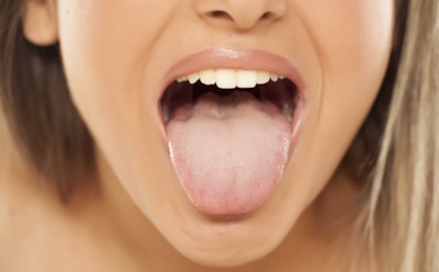 Стоматолог раскрыла, как отличить воспаление языка от других проблем в полости рта