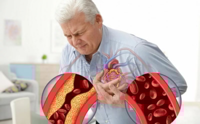 Боли нет — но сердце бьет тревогу: скрытые признаки болезней, которые нельзя игнорировать