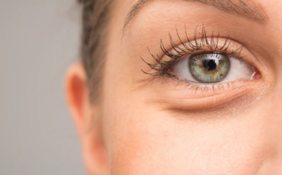 Генетика или образ жизни: что на самом деле стоит за мешками под глазами