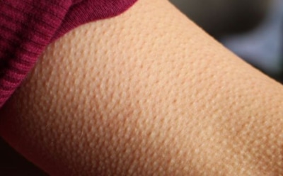 Трепет из далекого прошлого: ученые объяснили механизм появления мурашек и их связь с эмоциями