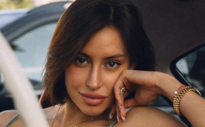 Невеста Тимати рассказала, как борется с облысением после беременности: частые причины и профилактика