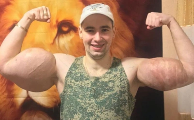 Кириллу «Руки-Базуки» грозит смертельная опасность: хирург рассказал об осложнениях