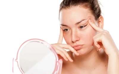 Прыщи и лишние волосы: гинеколог объяснила, какие симптомы выдают скрытую болезнь