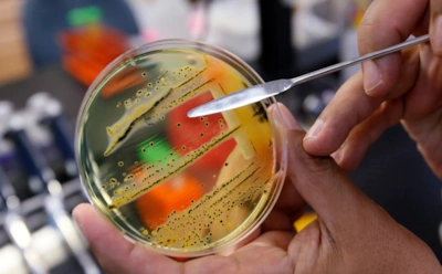 Как не заразиться сальмонеллой дома: 4 базовых правила от главного эпидемиолога - новости за декабрь 2025