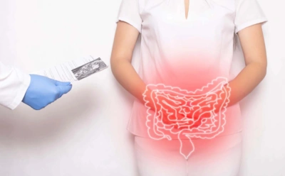 Если метеоризм мешает жить спокойно: как питание и привычки влияют на кишечник