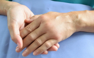 Как избавиться от отеков без таблеток: почему вы отекаете и что с этим делать