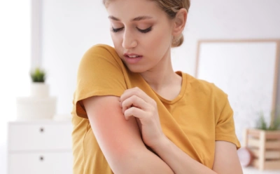 Если кожа чешется, а сыпи нет: эти внутренние сбои могут вызвать зуд без высыпаний