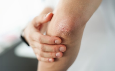 Если обычный крем уже не спасает зимой: этот аптечный рецепт избавит от сухости кожи за пару дней