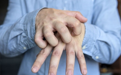 Трещины и шелушение на руках пройдут быстро: доступные рецепты без кремов и масок