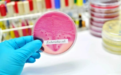 Осторожно — инфекции мочевыводящих путей: как кишечная палочка из мяса провоцирует ИМП у женщин