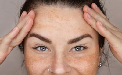 Пигментация усиливается с годами по ряду причин: что активирует меланин и как это остановить