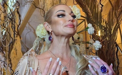 "Морили голодом!": Волочкова отдала миллионы за неудачную операцию в "худшей клинике Германии"