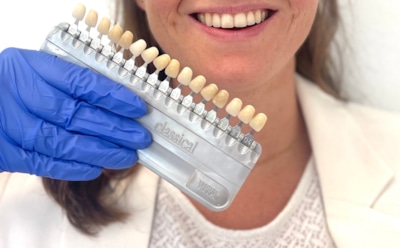 Ваша улыбка страдает от этих продуктов: привычная еда и напитки, которые меняют цвет эмали