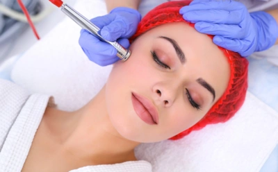 Дермабразия обновляет кожу глубже обычного ухода: процедура, которая помогает убрать рубцы и неровности