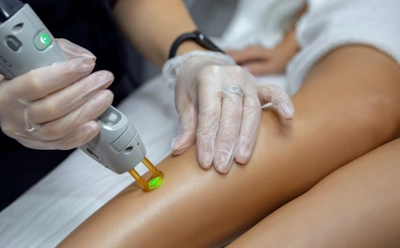 Руки и ноги первыми выдают возраст: эти аппаратные процедуры меняют состояние кожи