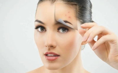 Почему кремы не справляются с акне: какие процедуры действительно уменьшают воспаления и рубцы